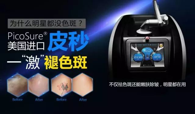 皮秒的优势是什么？