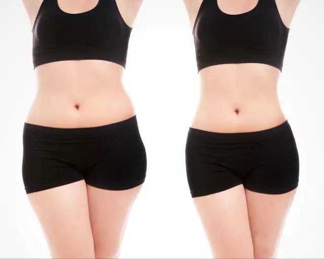 UltraShape优立塑非侵入式专利科技、有效、安全！
